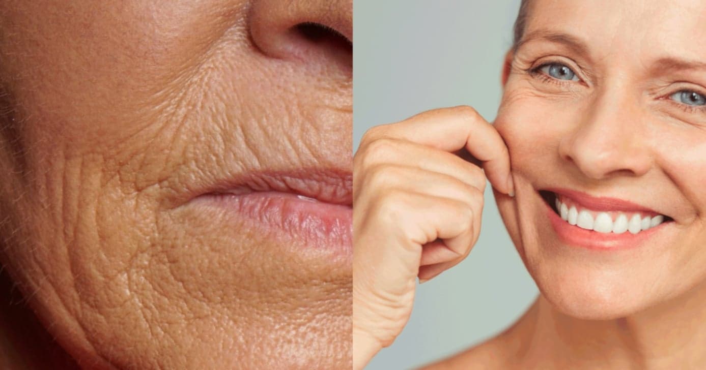 Renovação Facial Caseira